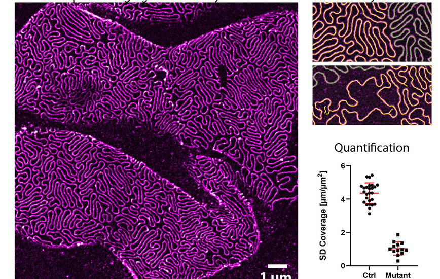 Genom 3D-mikroskopi kan njurens filterstrukturer, de 200–500 nanometer breda fotutskotten, visualiseras med ljusmikroskopi (vänstra bilden). Det möjliggör en enkel automatisk analys och kvantifiering av njurens hälsotillstånd (högra bilderna), med möjlig användning inom klinisk njurdiagnostik.