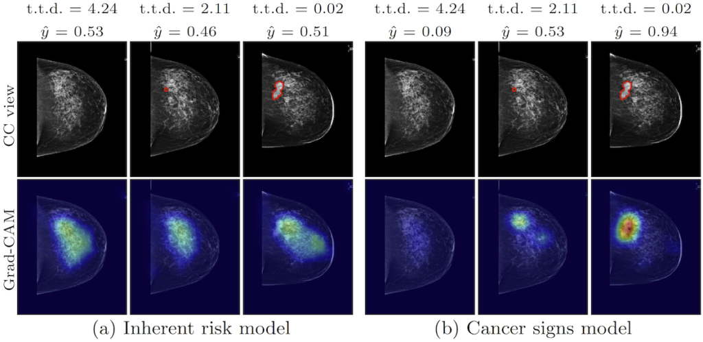 Den översta raden (i svartvitt) visar mammografibilder med en framväxande tumör inritad (t.t.d.=tid till diagnos): 4,2 år före diagnos, 2,1 år före diagnos och vid diagnos. Den nedre raden (i blått) visar hur två olika AI-nätverk bedömt bilderna. De tre bilderna till vänster illustrerar ett AI-nätverk tränat på att upptäcka generell riskinformation (“Inherent risk model”), medan de tre bilderna till höger illustrerar ett annat AI-nätverk tränat på att upptäcka tumörförändringar (“Cancer sign")