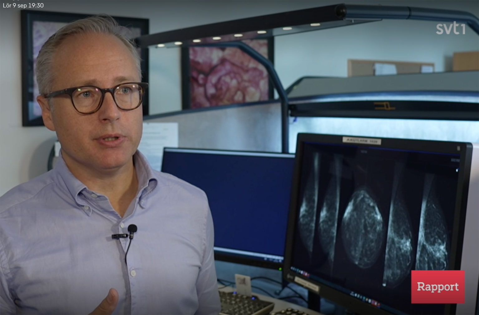 What happens next for breast cancer screenings?